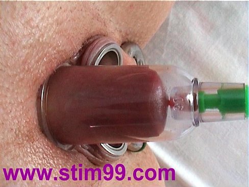 Offsides reccomend bdsm injections in clitoris hood